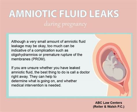 how to know if amniotic fluid is leaking|Water Breaking: What Are the Signs of Leaking。